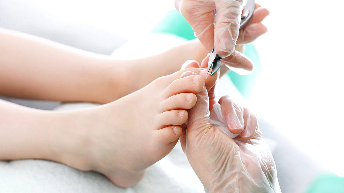 kadin-ayak-acisiz-duzeltme-tirnak-batmasi-bakimi